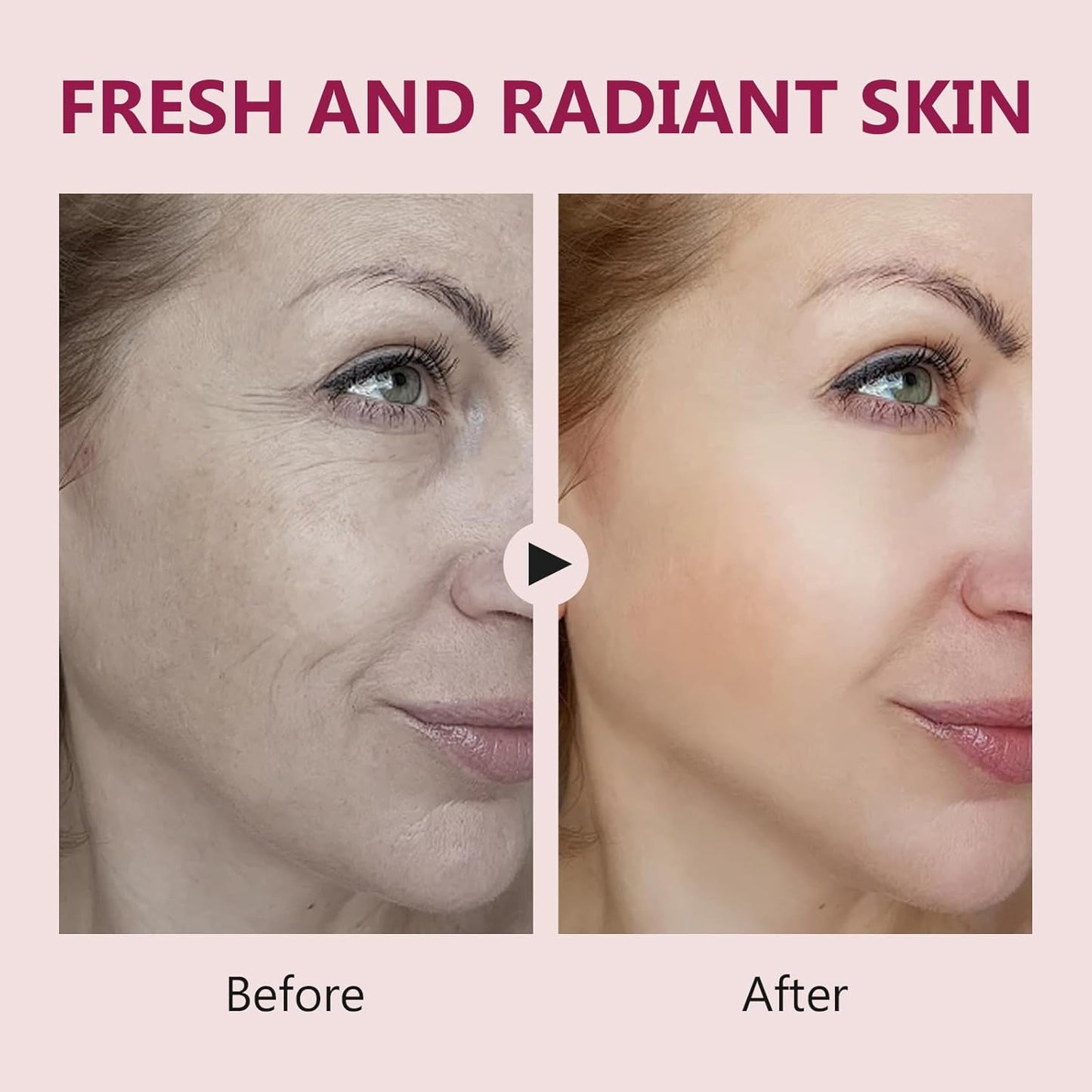 Salmon DNA Ampoule, Microneedling Serum, Anti-Wrinkle & Scar Removal for Face and Body, Salmon DNA Serum Ampoule Anti-wrinkle and Enhance Barrier Function