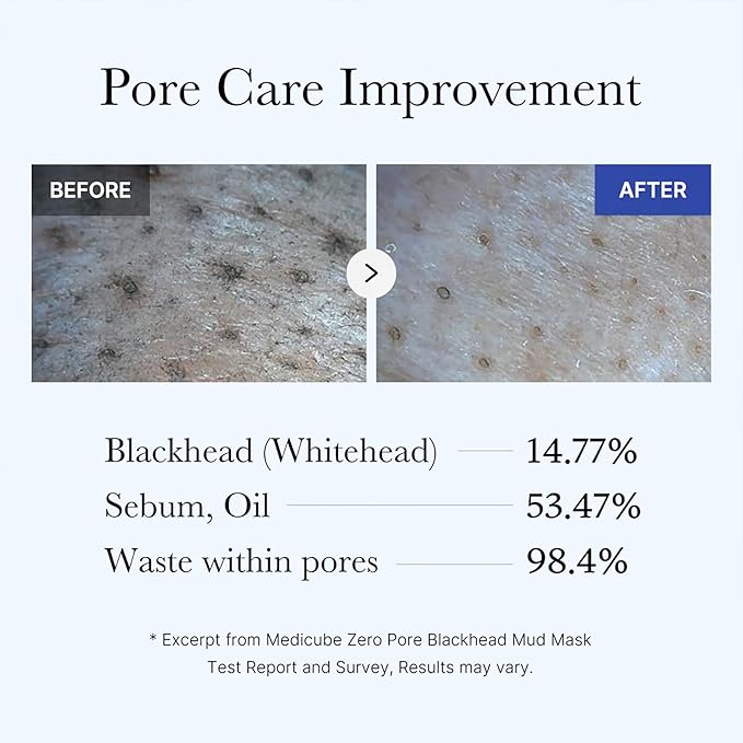 Medicube Home Care Duo for Flawless Skin: Zero Pore Blackhead Mud Facial Mask and Zero Foam Cleanser for Sensitive Skin