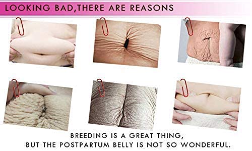 RtopR Mango Stretch Marks and Scar Cream -Stretch Marks and Scar Removal Cream for Pregnancy - Best Body Moisturizer-80g