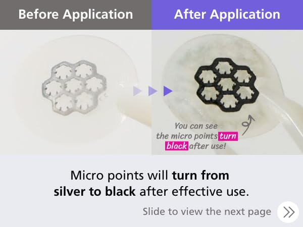 EasyDerm Magnesium Pimple Patches – Hydrocolloid Acne Spot Treatment with Ampoule & Tweezer, 10 Calming Zit Stickers by Daewoong, 이지덤, 대웅제약