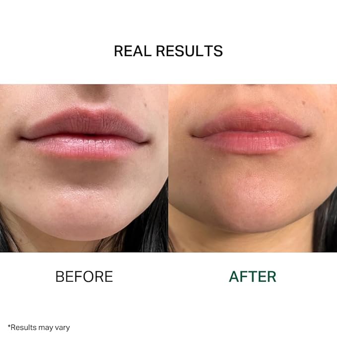 Y’OUR Intensive Lip Balm | Overnight Lip Mask: Lightweight & Comforting with Natural Shea Butter & Rosehip Oil; Extreme Moisturizer for Dry Lips. Paraben & Silicon-Free. Made in USA. 15ml (0.5 oz.)