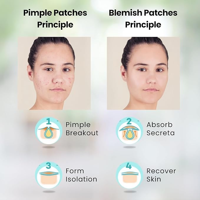 Dual Nature Advanced Formula Hydrocolloid Blemish Patches 12mm - Infused with Tea Tree Leaf, Lavender Extract & Salicylic Acid - Fights Blemishes, Soothe and Calms - Skin All Skin Types (30 Count)