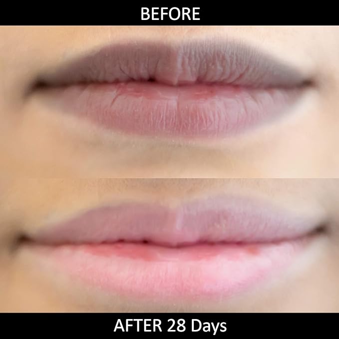 Omorfee 100% Organic Lip Lightening Stick for Dark Lips, Lip Whitening Lipstick with SPF, Natural Lip Balm Protection & Repair, Cocoa Butter, Carrot Seed Oil & Pineapple Extract - 6 Grams/0.21 Oz