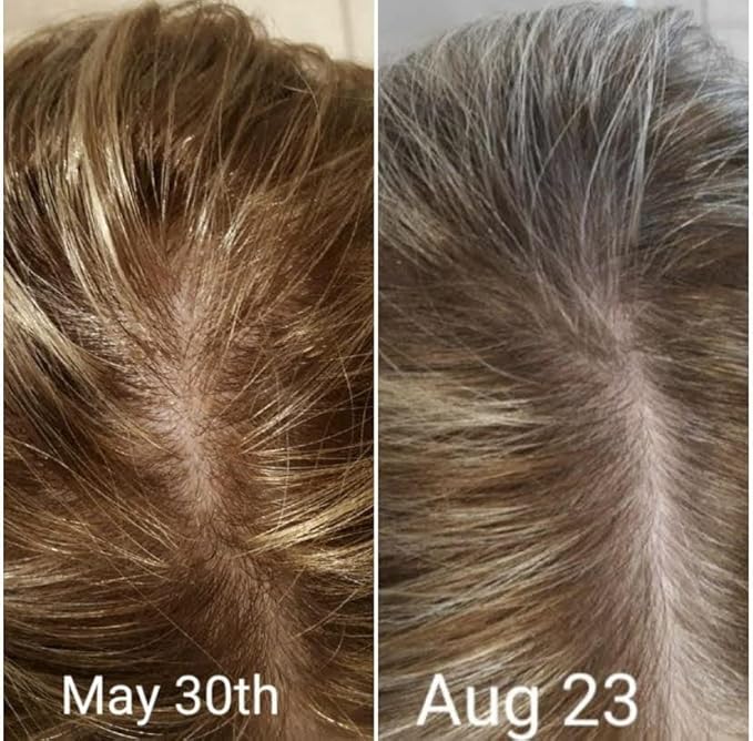 CRISAN 16oz Extreme Hair Growth and Strengthening Oil for Men and Women (16 fl oz)