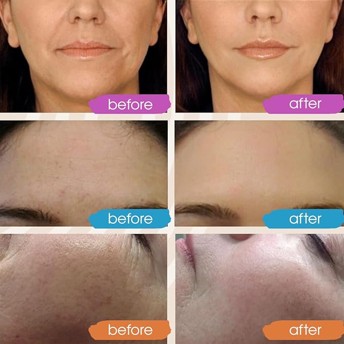 Retinol Serum for Face, Vitamin C with Hyaluronic Acid Face Serum for Women and Men, Glow Total Package Skin Care Set, Targets Appearance of Uneven Skin Tone and Dryness 3x2 oz