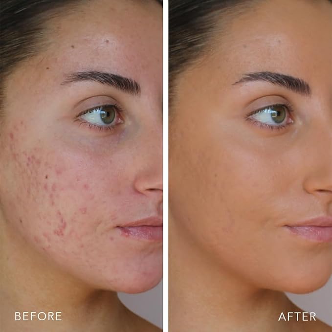 Doll 10 TCE Liquid Filter - Covers, Blurs, and Brightens (Deep/Rich)