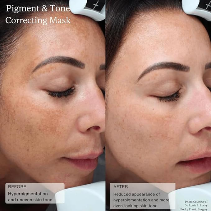 Senté Cysteamine HSA Pigment and Tone Corrector- Hyperpigmentation Treatment For Reducing The Appearance of Dark Spots And Improving Skin Tone - 1.7 Fl Oz