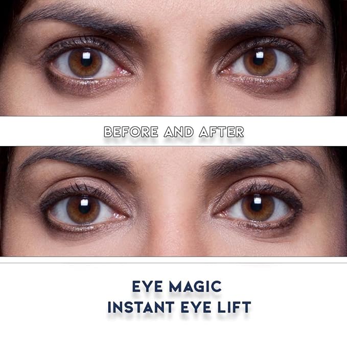 Eye Magic Premium Eye Lift (S/M Kit + Gel) Made in America Instantly Lifts and Defines Droopy, Sagging or Hooded Eyes Safe For Daily Use