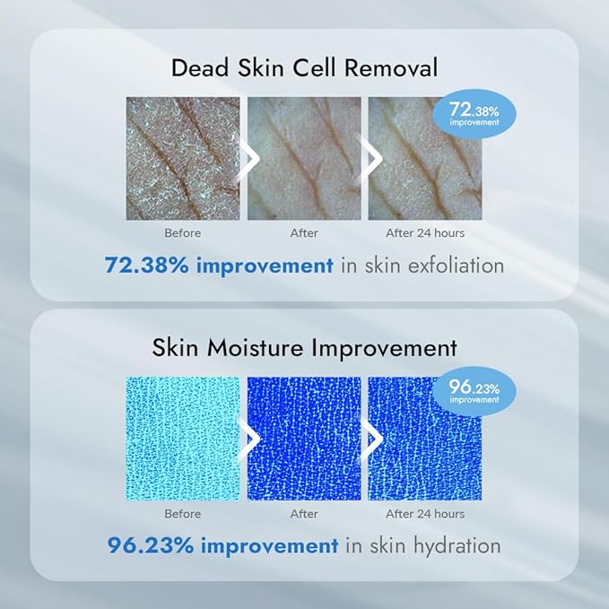 V11FACTORY AHA 12% Glycolic Acid Body Lotion – Korean Exfoliating & Hydrating Body Cream with Hyaluronic Acid & Collagen – Unscented, Paraben-Free Skin Smoothing Moisturizer, 10.6 oz