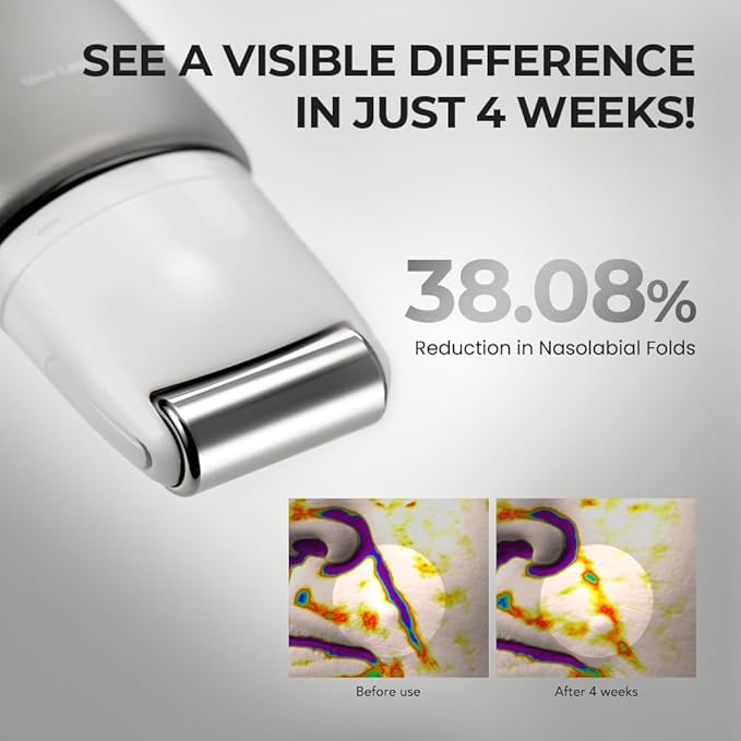 [SKIN&LAB] Retinol Lifting Roller Cream with Massage applicator, Vegan Anti Aging Face and Neck Cream for Reduce Wrinkles and Fine Line, For Face, Neck, Décolleté Wrinkle Care, 1.69 fl. oz.