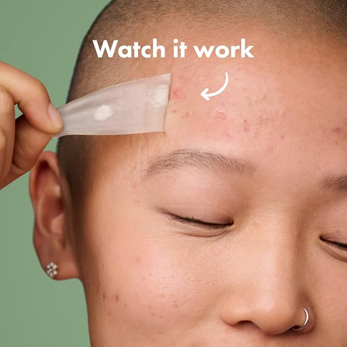 Mighty Patch Surface Large Pimple Patches for Face from Hero Cosmetics, Acne Spot for Body, Cheek, Forehead, and Chin, Pimple Stickers, Hydrocolloid Covers, Vegan-friendly, 10 Count