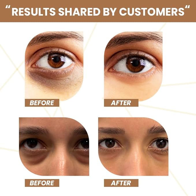 RAWLS 5% Caffeine Eye Serum and Under Eye Roller Cream for Dark Circles and Puffiness, Caffeine Eye Cream with 360° Massage Ball Reduce Wrinkles and Fine Lines-0.5 fl oz