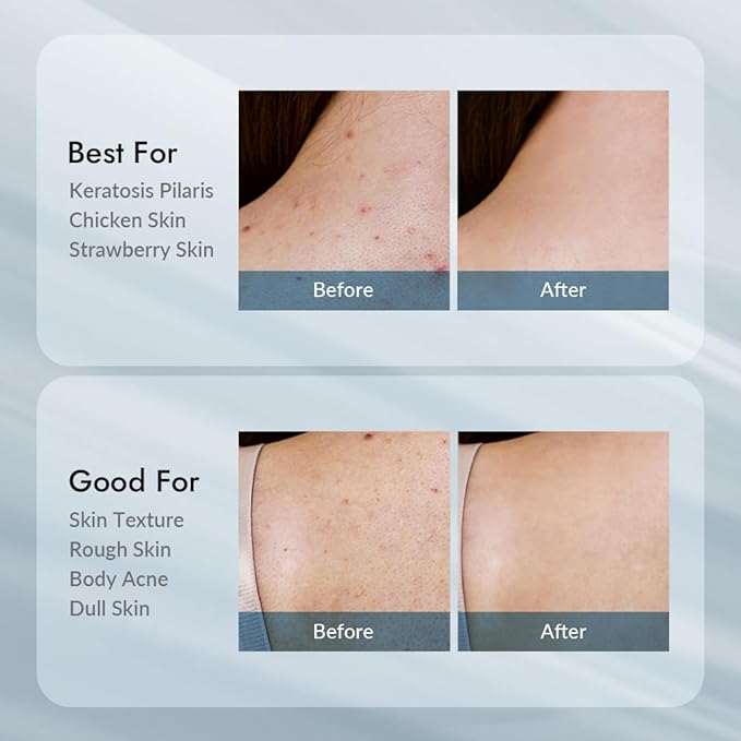 V11FACTORY AHA 12% Glycolic Acid Body Lotion – Korean Exfoliating & Hydrating Body Cream with Hyaluronic Acid & Collagen – Unscented, Paraben-Free Skin Smoothing Moisturizer, 10.6 oz