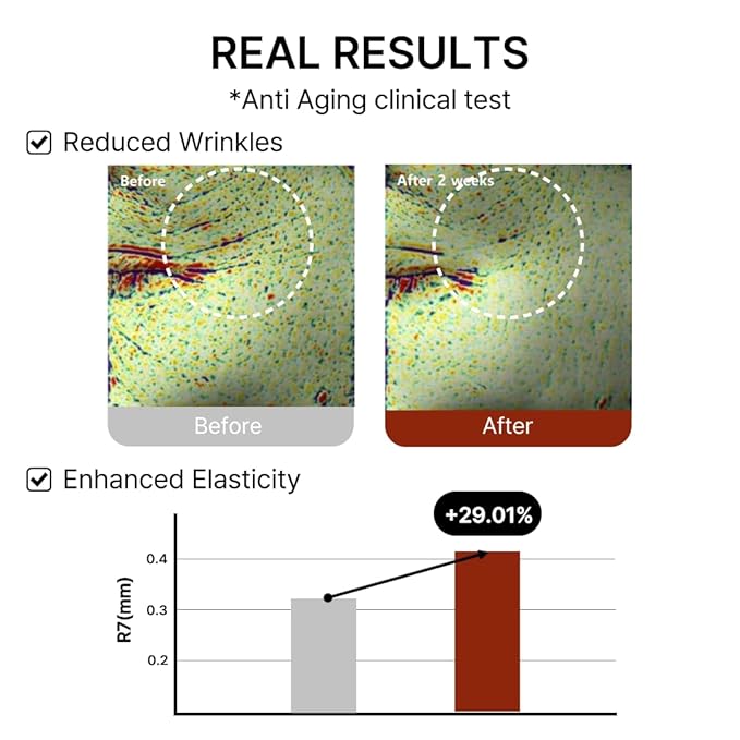 Mito-on Cell Rejuvenation Anti-Aging Serum, 30ml / 1.01 fl.oz –10% Niacinamide, Vitamin B3 and Antioxidants, Centella + EGF for Anti-Aging, Wrinkle Reduction, Pore minimization, Korean Skin Care