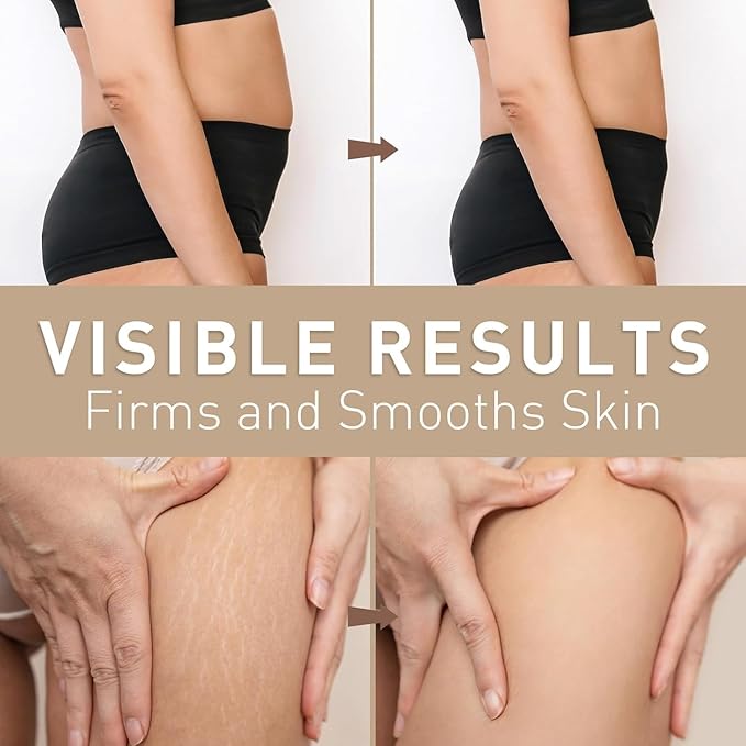 Belly Firming Cream for Tightening & Cellulite – Skin Firming Cream for Stomach, Thighs & Butt – Moisturizing & Lifting Body Lotion for Women