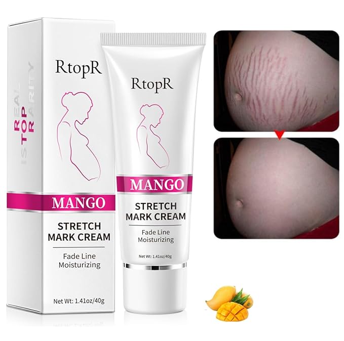 Stretch Mark Removal Cream, Obesity Stretch Mark Moisturizer, Postpartum Repair Stretch Mark Cream, Abdominal Stretch Mark Cream, Remove Marks (1 PCS)