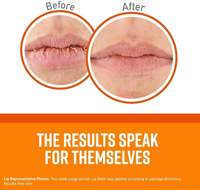 O'Keeffe's Unscented Lip Repair Lip Balm for Dry, Cracked Lips, Stick, (Pack of 5)