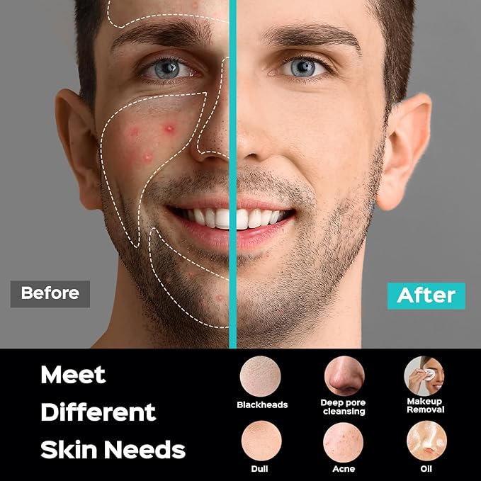 COSLUS Facial Cleansing Brush Face Scrubber : Portable Silicone Waterproof Rechargeable Face Wash Brush, 5 Cleansing Modes, Electric Deep Cleaning for Men & Women, Removing Blackhead, Exfoliating