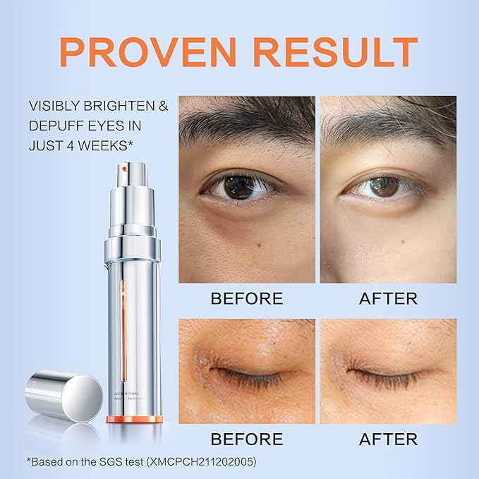 Elastic Brightening Youth Activating Eye Cream for dark circles and puffiness, 0.71 oz