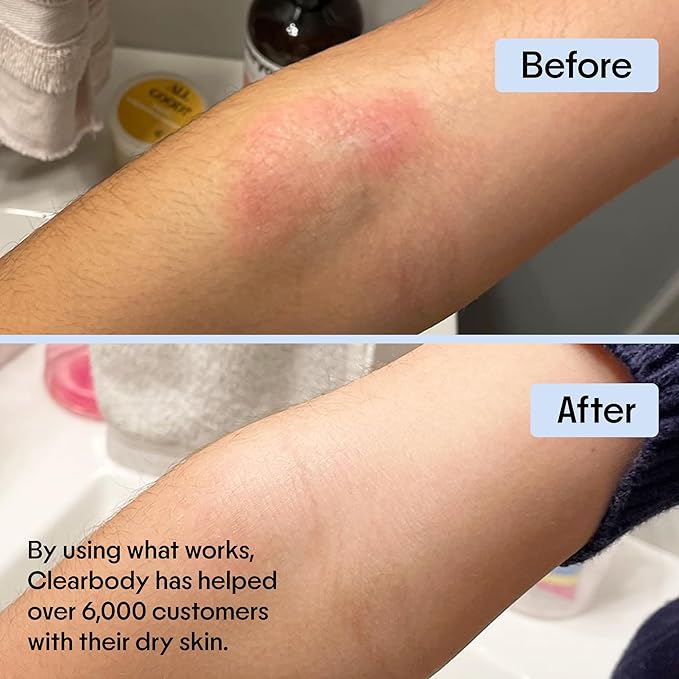 Clearbody Organics Colloidal Oatmeal Eczema Cream with Manuka Honey - 4 oz - Plant-Based Moisturizer & Eczema Ointment for Dry, Itchy Skin Relief