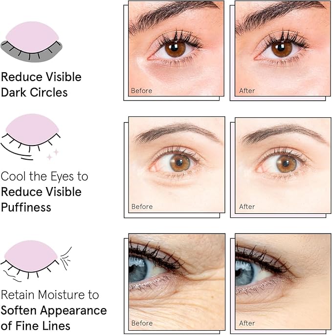 grace & stella Award Winning Under Eye Mask - Reduce Dark Circles, Puffy Eyes, Undereye Bags, Wrinkles - Gel Under Eye Patches - Gifts for Girlfriend - Vegan Cruelty-Free Self Care (48 Pairs, Pink)