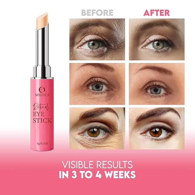 Instant Eye Bag Remover, Retinol Eye Cream for Dark Circles, Under Eye Brightener Stick, Under Eye Cream Anti Aging, Eye Cream for Wrinkles, Brightening Eye Cream for Puffiness and Bags