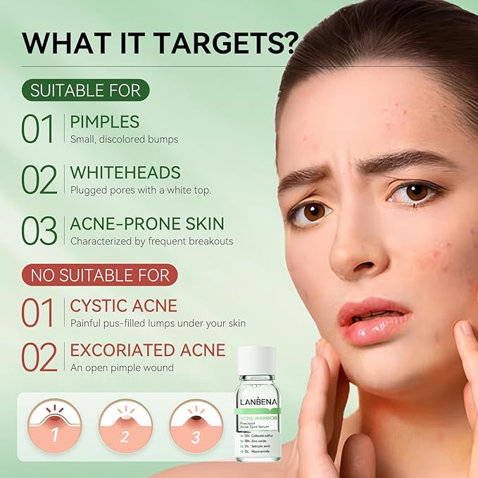 LANBENA Precision Acne Spot Serum, Acne Drying Lotion, Overnight Acne Treatment For Face, Dry Out Pimples, Blemishes, Zits And Clean Pores, 0.42 Fl Oz