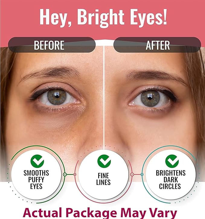 Eye Mask for Puffiness - Under Eye Patches for Dark Circles - Korean Under Eye Mask Patches for Puffy Eyes - Eye Gel Pads Depuffing Eye Brightener with Rose, Caffeine, Hydrogel & Collagen (10 Pairs)