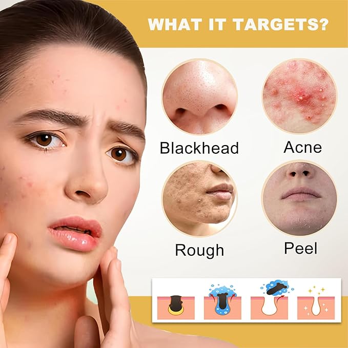 Peel Shot White Rice Peeling Ampoule - Soft Exfoliating Face and Body Scrub - Rice Exfoliator for Face Dead Skin Remover for Body - Deep Pore Cleanser Facial Scrub Exfoliator for All Skin Types