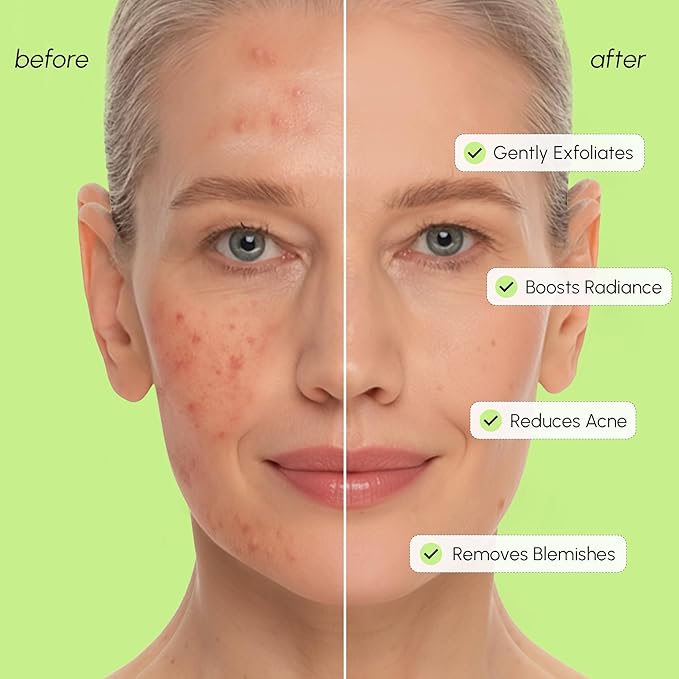 MAREE Exfoliating Toner with Salicylic Acid – AHA BHA Exfoliant & Face Exfoliator Pore Cleaner – BHA Liquid Exfoliant – Sebum Dead Skin Care Remover for Face – Exfoliante Para la Cara Acido Salicilico