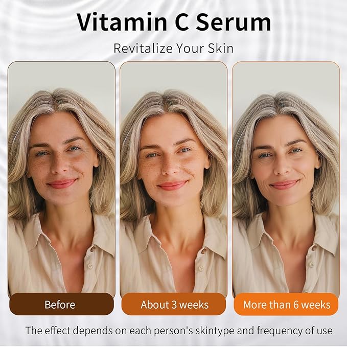 Vitamin C Retinol Serum for Face, Brightening & Anti-Aging with Hyaluronic Acid, Vitamin E, Peptides, Collagen - Hydrates, Firms, Lifts, Smooths, Targets Age Spots, Wrinkles, 1.7 Fl Oz