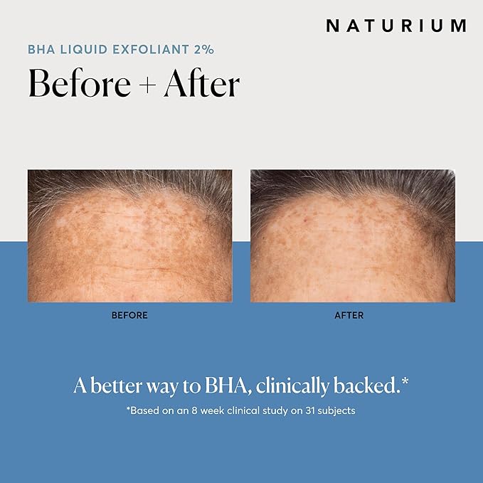 Naturium BHA Liquid Exfoliant 2%, Leave-on Face & Skin Care Exfoliating Pore Treatment, with Salicylic Acid & Bioactive Fruit Acids, Packaging May Vary, 4 oz