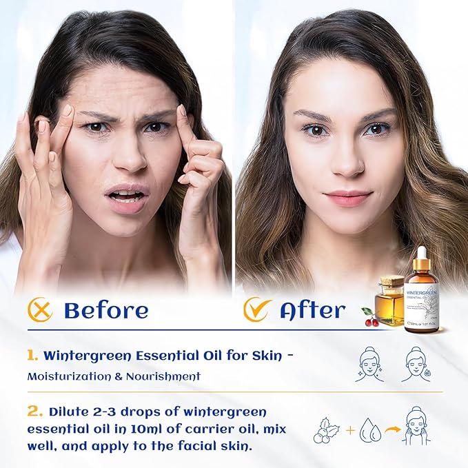 HIQILI 1 Fl Oz Wintergreen Essential Oil, 100% Pure Natural for Skin, Diffuser - 30ml