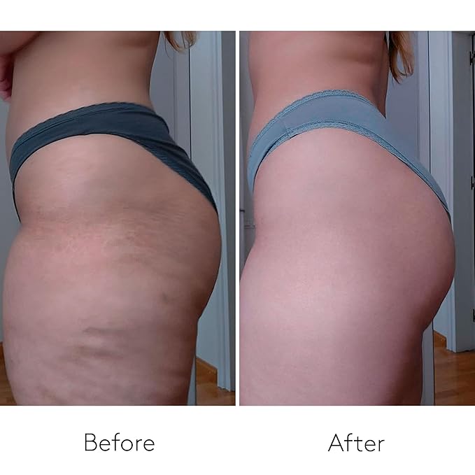 COCUNAT - Body Power - Anti Cellulite Cream - Body Firming Cream - Cellulite Remover - Toned Skin - With Caffeine and Hyaluronic Acid - 150 ml + 125 ml