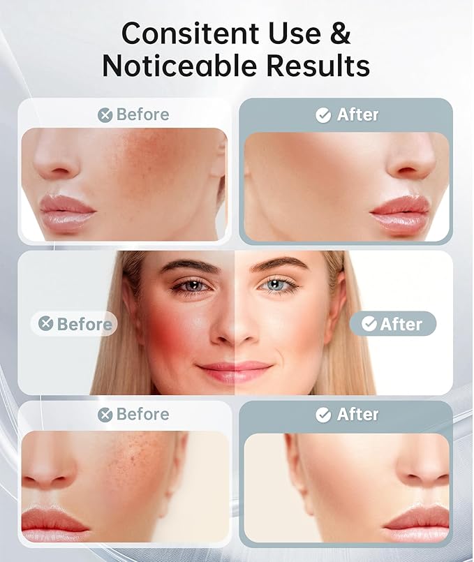 7 Color Light Therapy Facial Massager with Adjustable Vibration and Thermals for Wrinkles, Double Chin, Red Light Skin Care Tool with Base, Pink