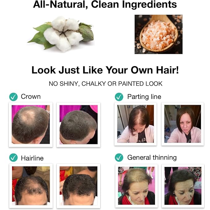 Hair Loss Concealer. Covers Bald Spot And Makes Thin Hair Look 10X Fuller Instantly. All-Natural Hair Building Fiber. Trial Size, 10-Day Supply. Gray