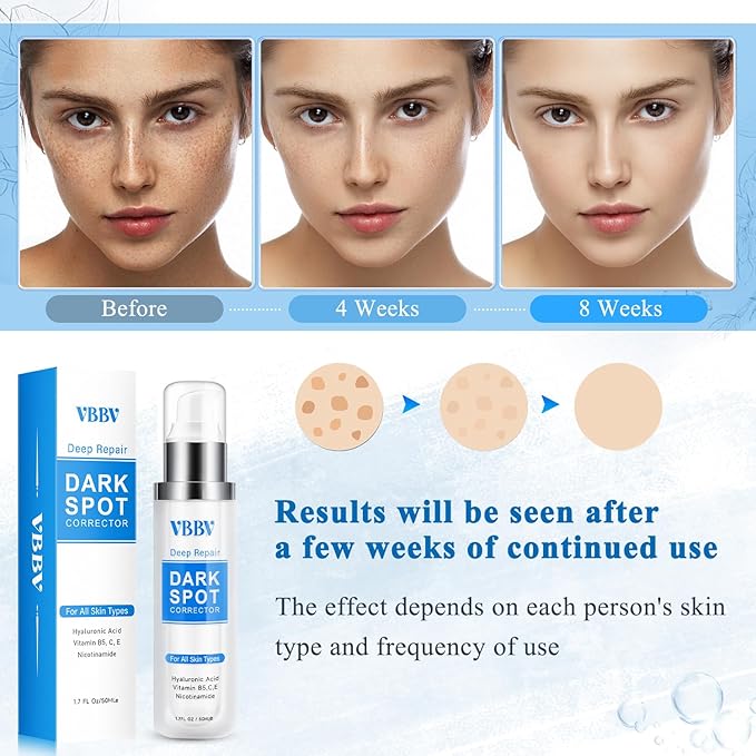 Dark Spot Remover for Face and Body, Dark Spot Corrector, Age Spot Sun Spot Freckles Dark Spot Remover, Melasma Treatment for Face, Advanced Skin Care Cream for Women and Men (1.7 Fl Oz)