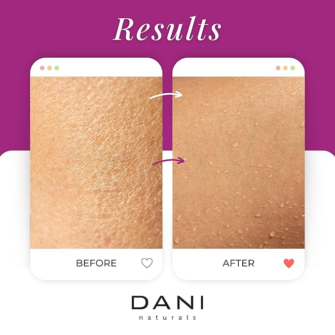 Naturals Sugar Scrub – Pure & Gentle Exfoliation with Juicy Passion Fruit Scent. Organic sugar, shea butter, and nourishing oils for smooth, soft skin – 14 oz