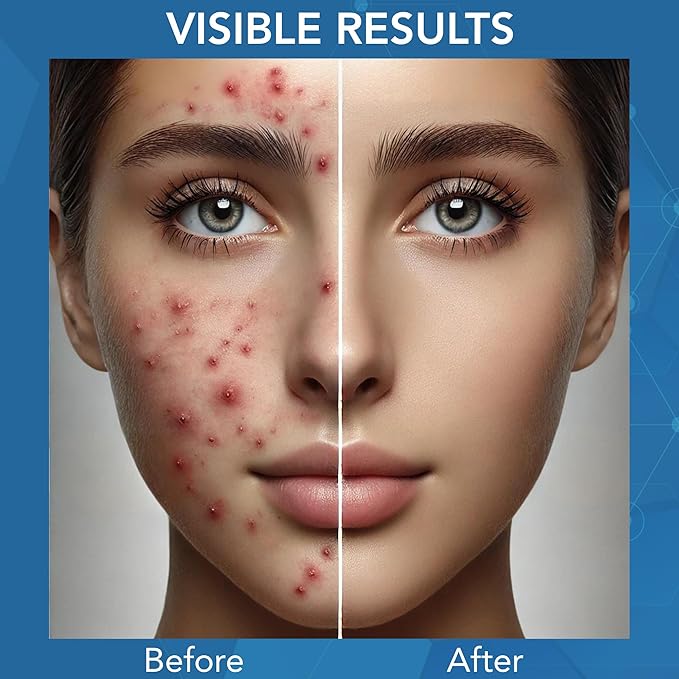 NOVEHA Facial Cleanser For Acne - Hypochlorous Acid Spray - Irritation, Redness & Breakouts Relief - Ideal for Active Teenage & Adult Athletes Post-Workout - Safe for Multiple Daily Uses - 8 oz