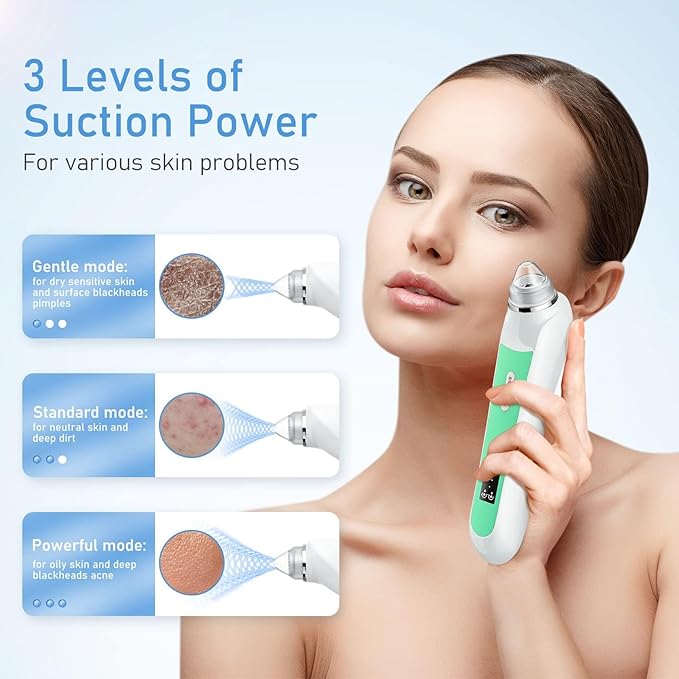 Facial Pore Blackhead Remover Vacuum, 1080P Camera Blackhead Remover, 20x Zoom, 8 LEDs ＆ 3 Suction Modes, 800mAh Battery & USB - 6 Heads Pore Cleaner Kit for Women&Men(Green)