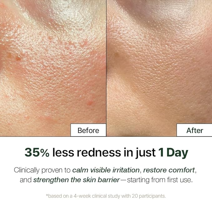 NDP Cica Cream - Gel Face Moisturizer for Sunburn Relief, lightweight Korean Moisturizer for Sensitive Skin, Centella Asiatica, Hydrating, Calming, Soothing (1.7 Fl oz / 50ml)