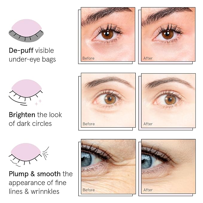 grace & stella Under Eye Patches (12 pairs) Eye Masks for Dark Circles and Puffiness - Birthday Gifts for Women, Bachelorette Party Favors, Bridesmaid Proposal Gifts, Self Care, Spa, Relaxation, Vegan