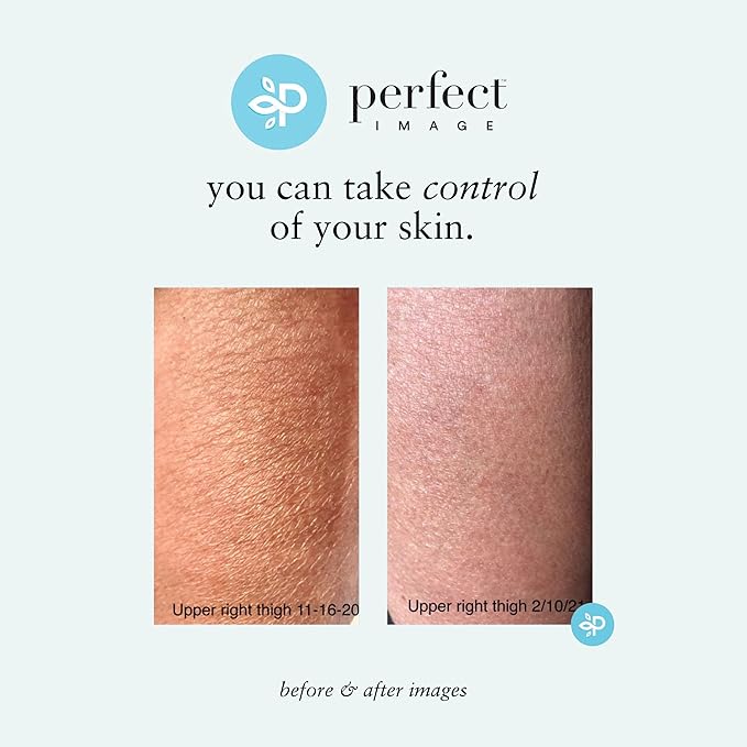 Perfect Image Gly + Sal Exfoliating Body Lotion, 8% Glycolic Acid and 2% Salicylic Acid Lotion Enhanced with Green Tea, Papaya, Bearberry, Licorice and Amino Complex