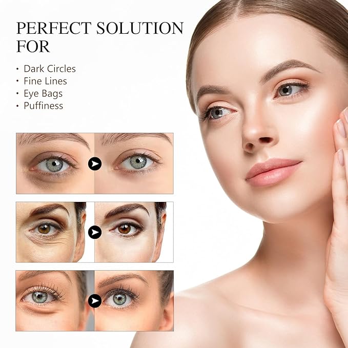 Caffeine Eye Serum Anti Aging, Eye Serum for Dark Circles and Puffiness, Retinol Eye Cream with 360°Massage Ball, Reduce Eye Wrinkles and Fine Lines