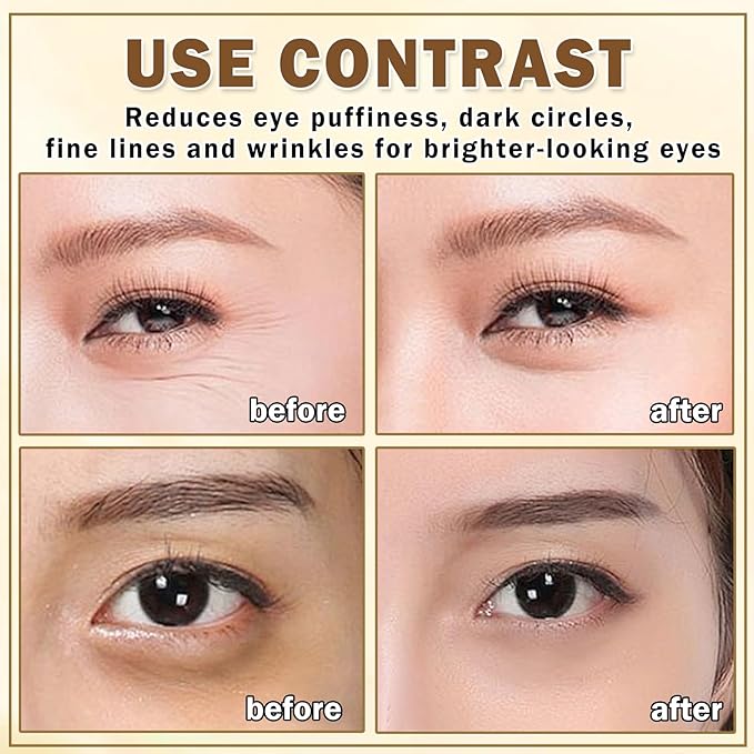 Eye Cream for Dark Circles Puffiness and Bags Eye Serum Eye Roller for Puffy Eyes Under Eye Cream for for Women Daily Skincare Crema Para Las Ojeras