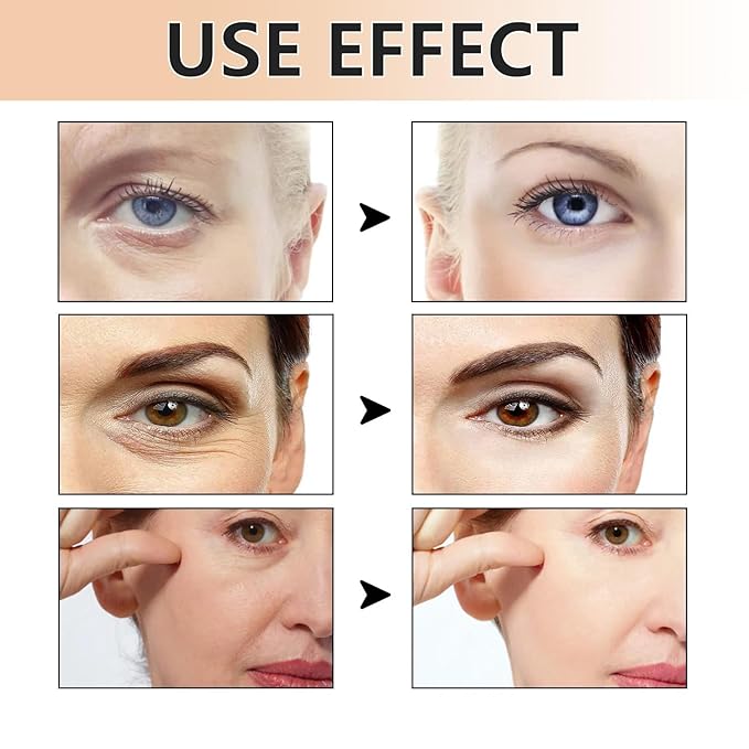 Eye Cream,Eye Tightener Cream, Eye Firming Cream,Under Eye Firming,Temporary Eye Tightener (2 PCS)