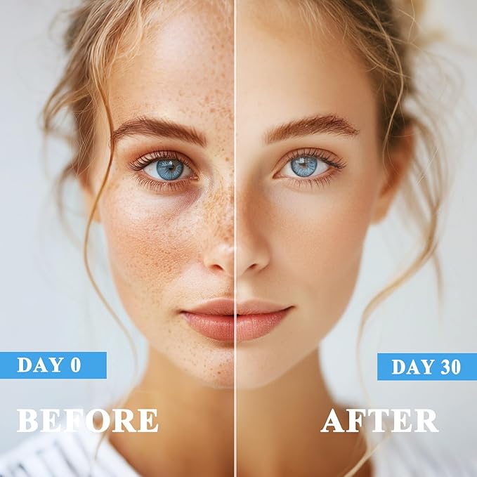 Dark Spot Remover for Face and Body, Dark Spot Corrector, Age Spot Sun Spot Freckles Dark Spot Remover, Melasma Treatment for Face, Advanced Skin Care Cream for Women and Men (1.7 Fl Oz)