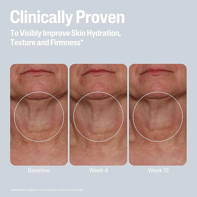 Cetaphil Skin Activator Hydrating & Firming Body Cream 12oz, Mandelic Acid (AHA) and Centella Asiatica (CICA) Cream, Hydrates and Firms Aging Skin, Anti-Aging Skin Care, 12 oz