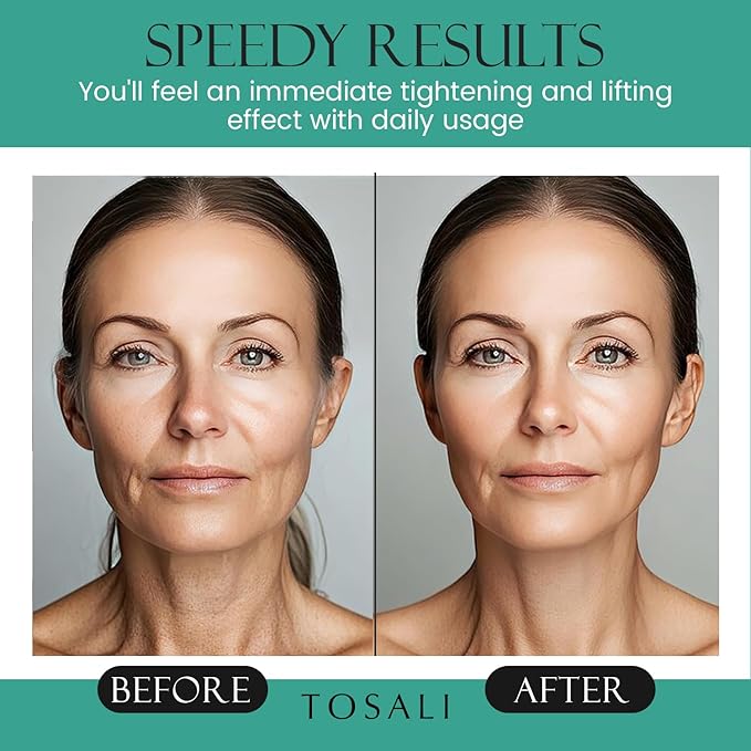 Anti Aging Face Cream for Women, 1.7 oz - Niacinamide Cream, Hydrating Face Moisturizer with Multivitamins - Day & Night Cream for Face with Anti Aging Effect, Skin Care for All Skin Types