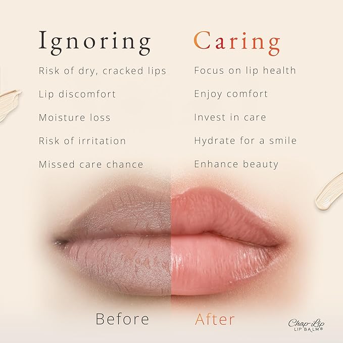 CHAP-LIP Original Lip Balm Hydrating Bulk Chap Stick with Fruit Flavors, Coconut Oil, and Cocoa Butter - Lip Therapy Pack for Men and Women - Gift Set Made in the USA, 24 Pack x 12 Box